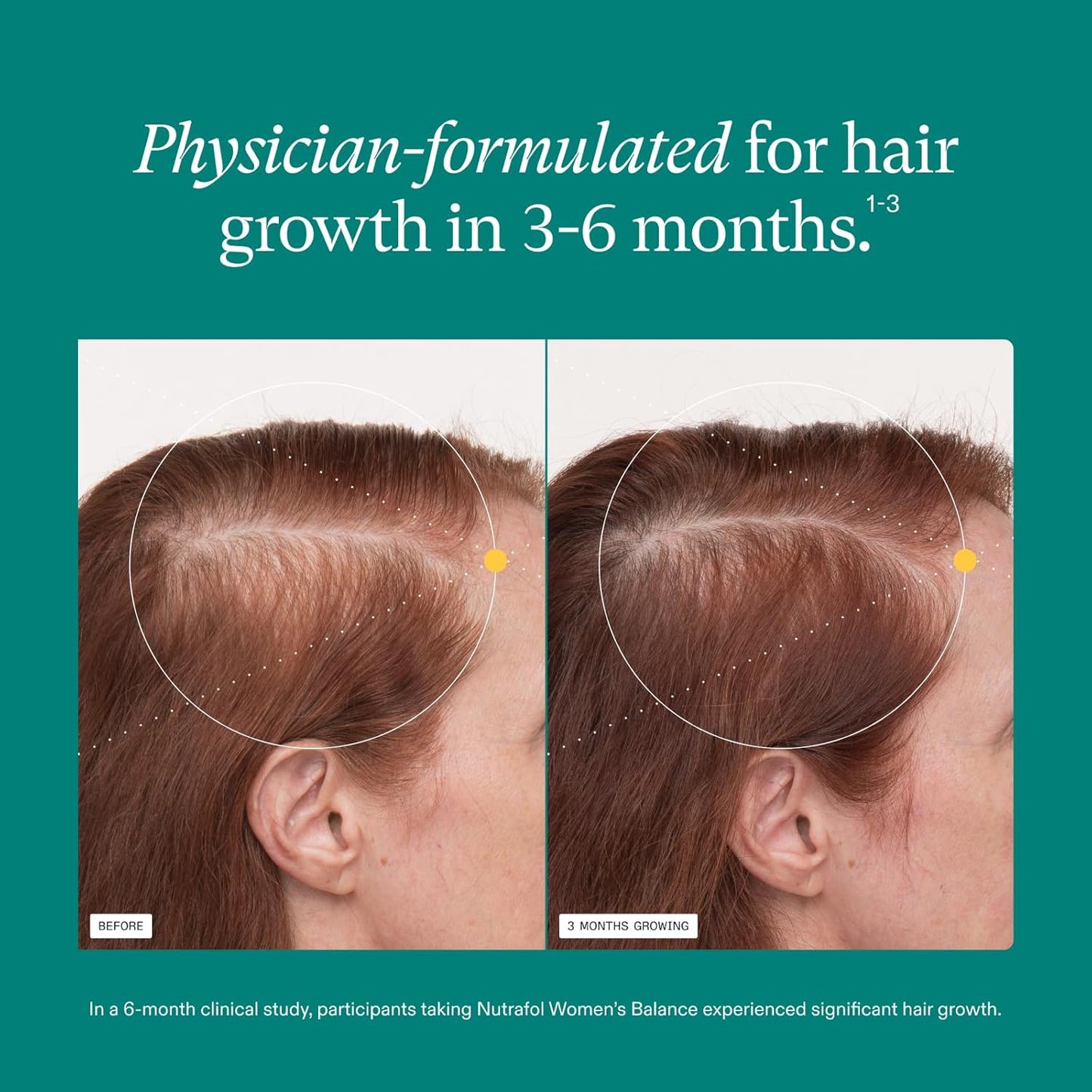 Nutrafol Women Hair Growth Supplements
